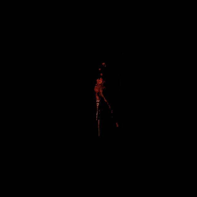 Blood Hit - Front - 007